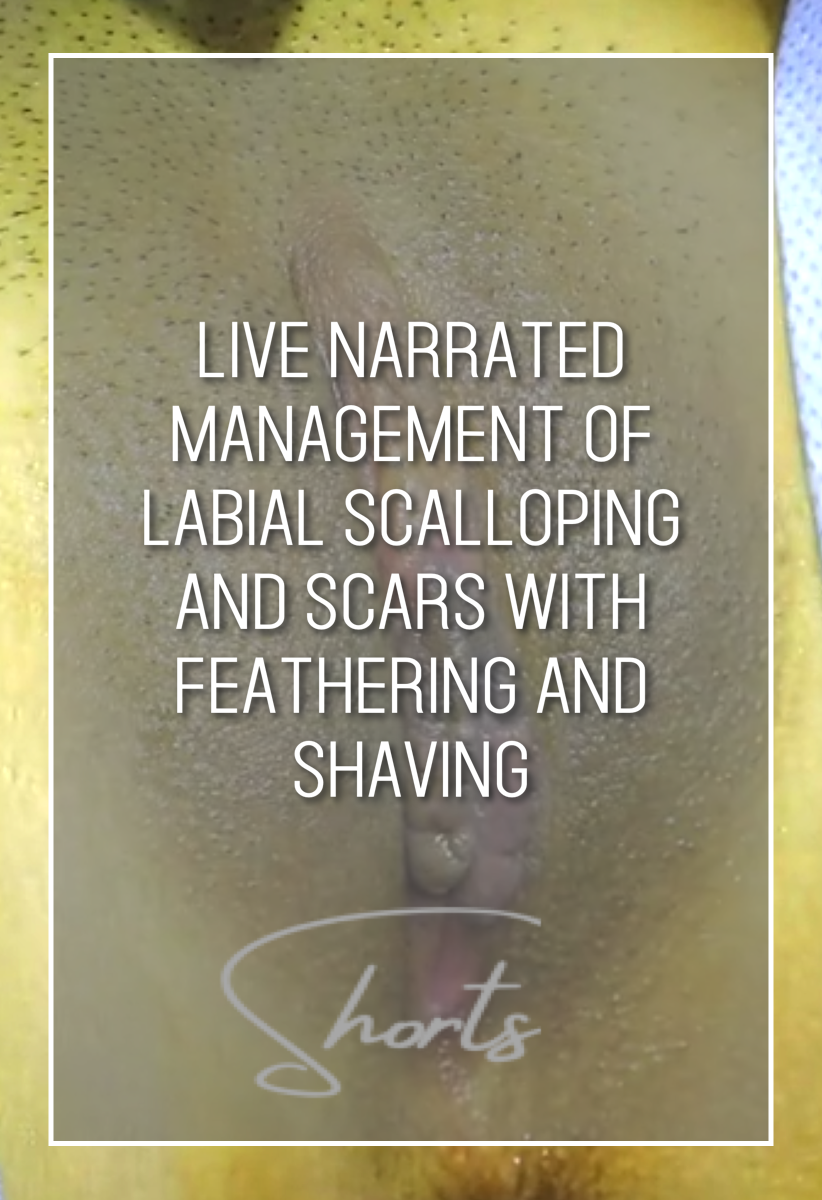 2 AIAVS Fellows Video 155, Live Narrated Management of Labial Scalloping and Scars with Feathering and Shaving Short