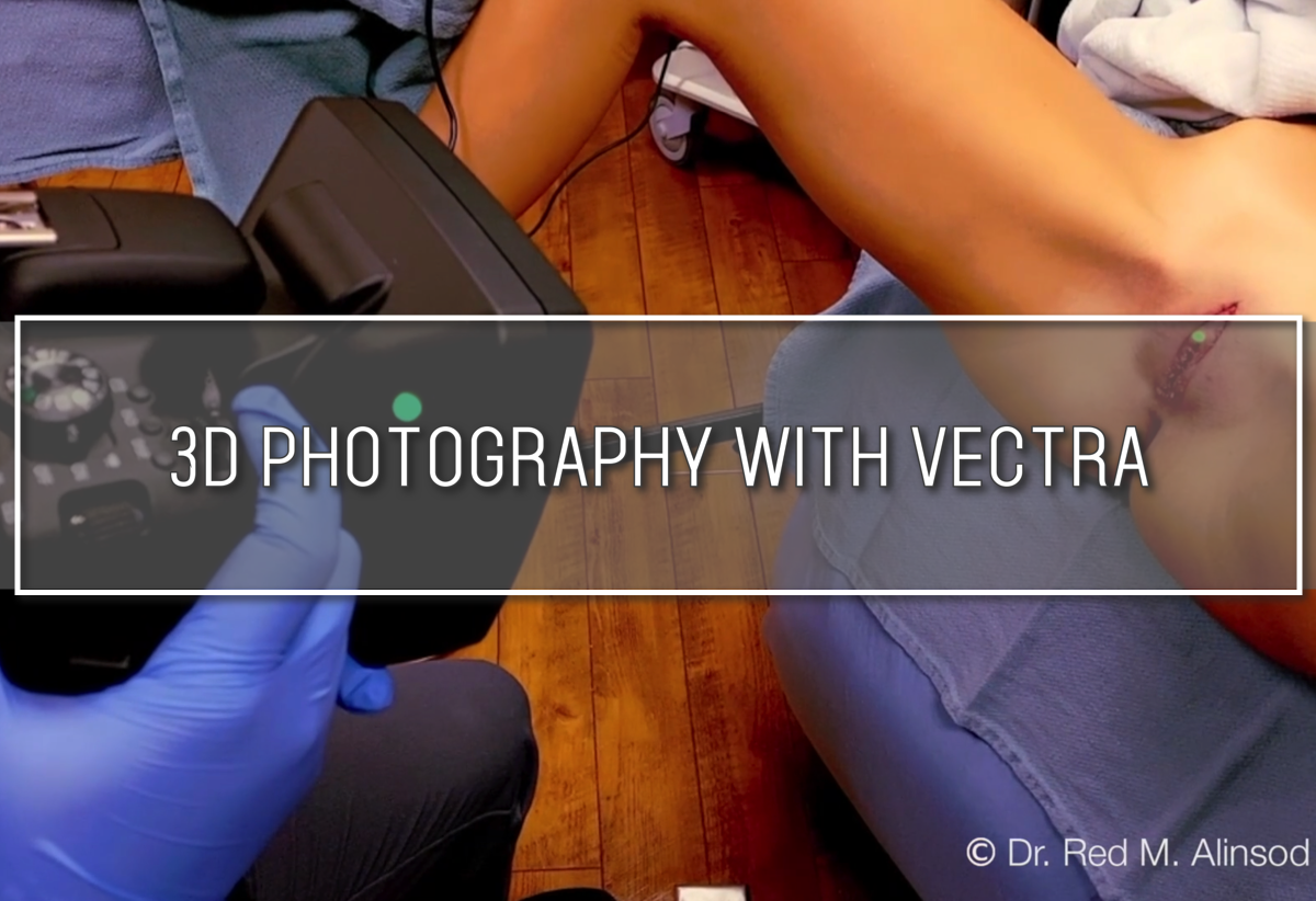 3D Photography with Vectra