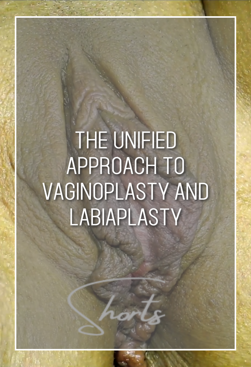 Alinsod 15 The Unified Approach to Vaginoplasty and Labiaplasty Short