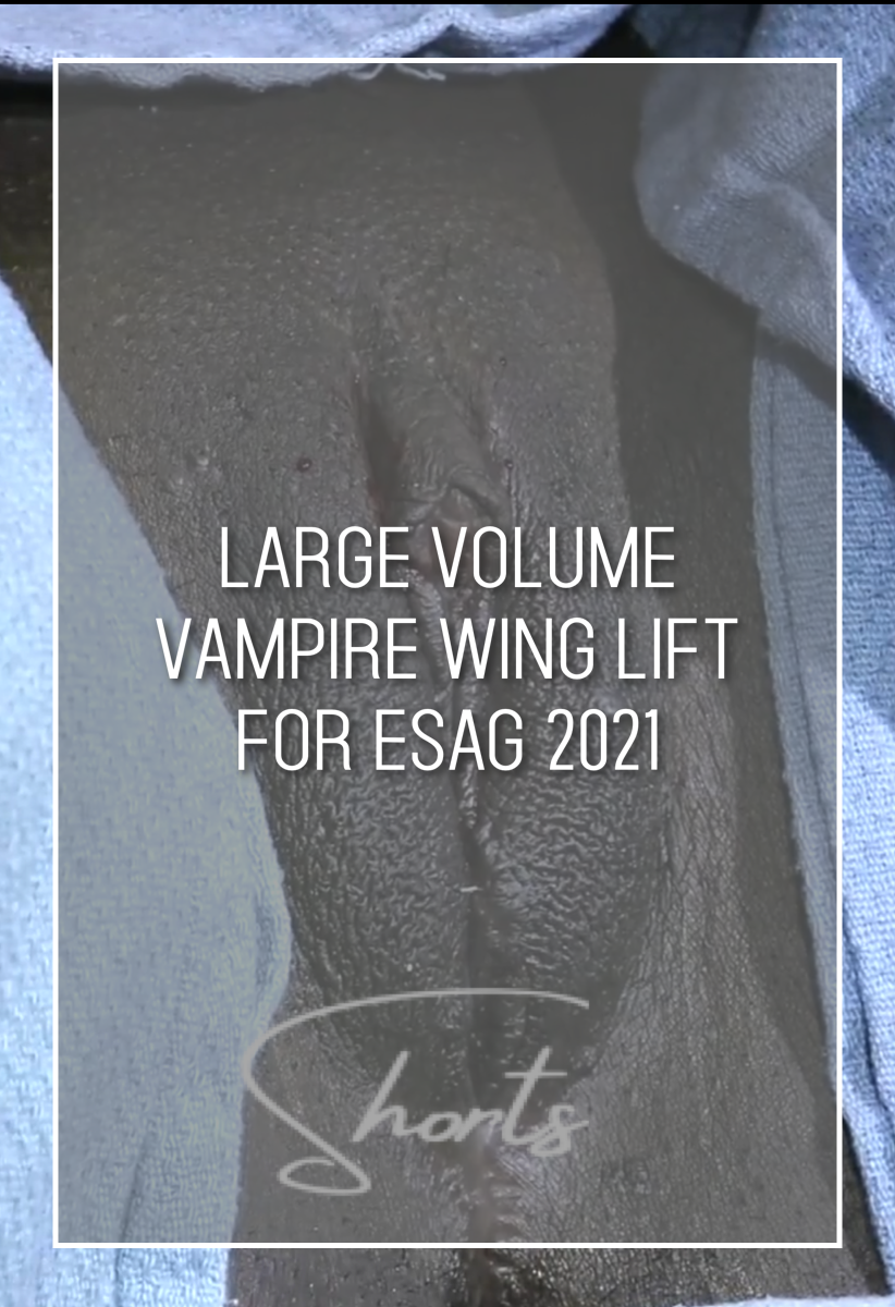 Large Volume Vampire Wing Lift for ESAG 2021