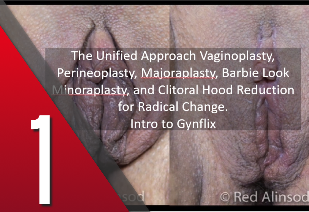 UA Vaginoplasty, Perineoplasty, and Majoraplasty