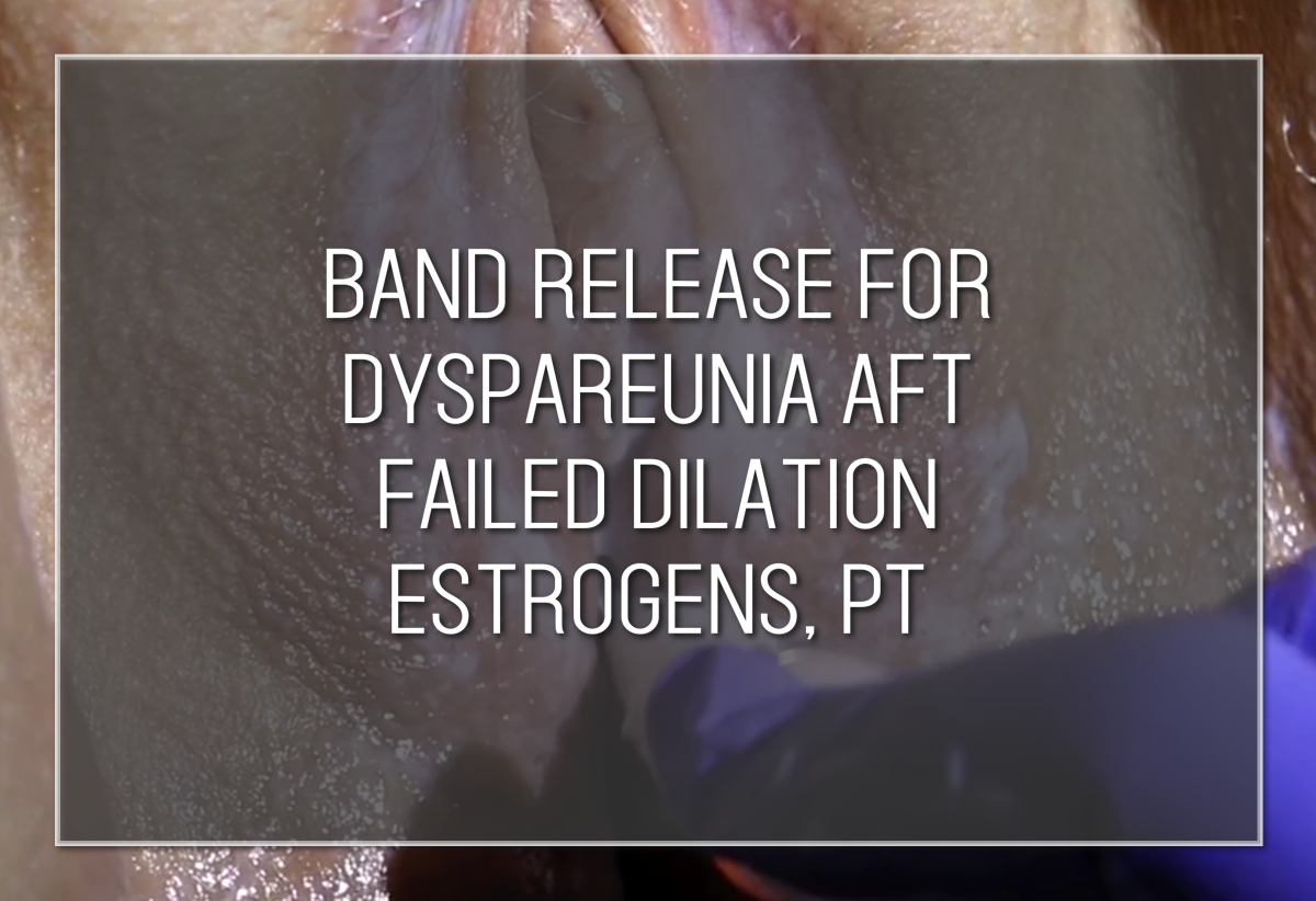 Labiaplasty Hybrid