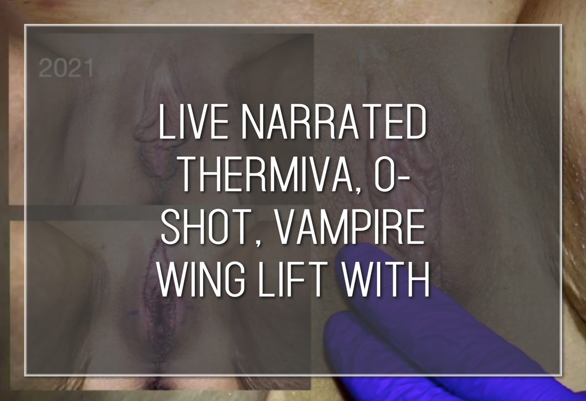 Labiaplasty Hybrid