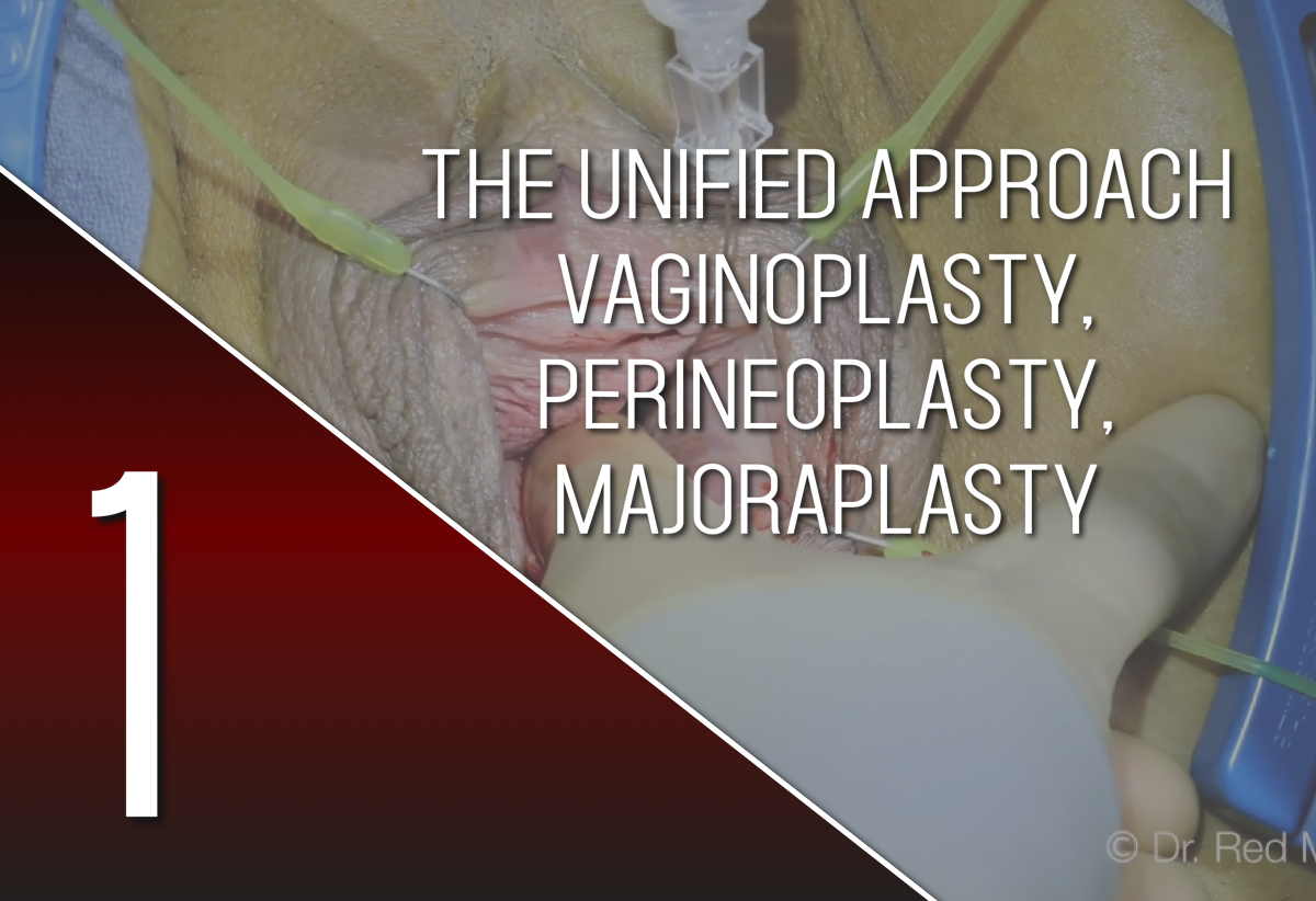 UA Vaginoplasty, Perineoplasty, and Majoraplasty