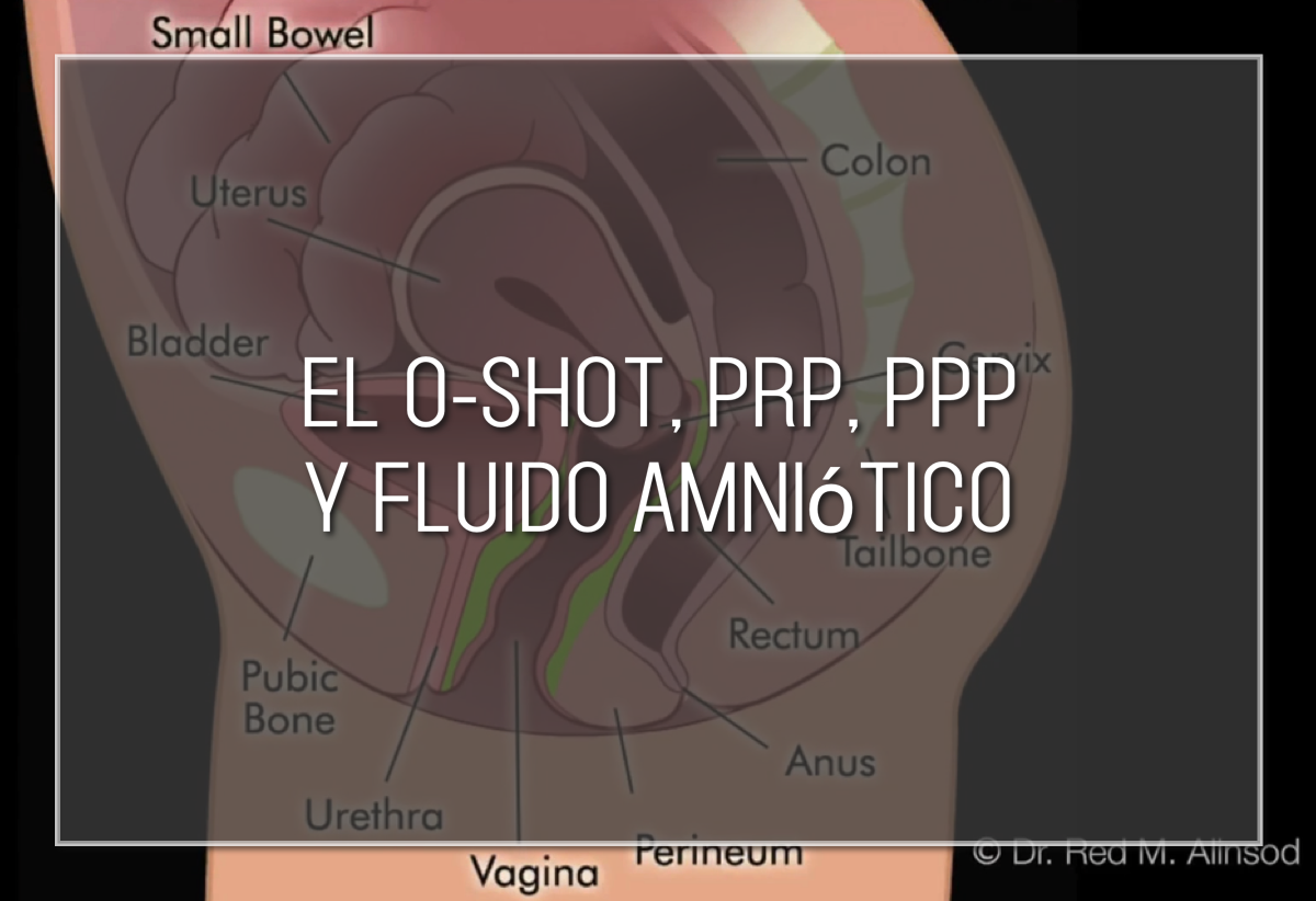 Labiaplasty Hybrid